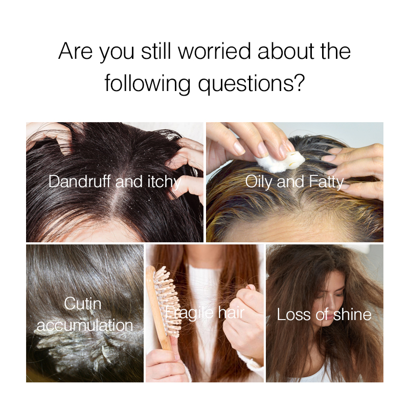 PURC Haar-Kopfhaut-Behandlung, – Hair Care Dandruff Bewertung und Preis