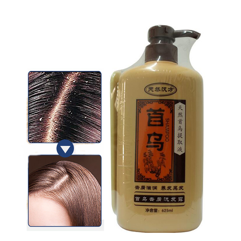 Professionelle Natürliche Chin – Hair Care Dandruff Bewertung und Preis