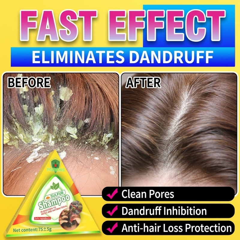 Haarausfall-Wegbereiter in fes – Hair Care Dandruff Bewertung und Preis